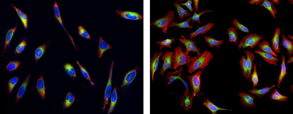 Cell Navigator® Live Cell Endoplasmic Reticulum (ER) Staining Kit *Green Fluorescence* - AAT Bioquest