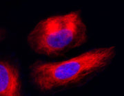 Cell Navigator® Live Cell Tubulin Staining Kit - AAT Bioquest