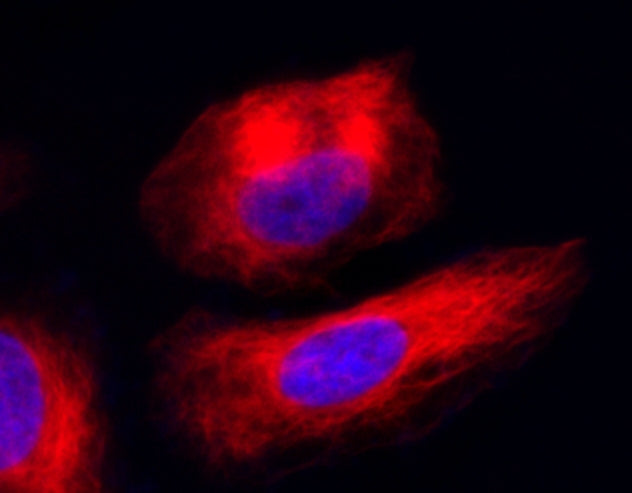 Cell Navigator® Live Cell Tubulin Staining Kit - AAT Bioquest