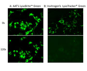 Cell Navigator® Lysosome Staining Kit *Green Fluorescence* - AAT Bioquest