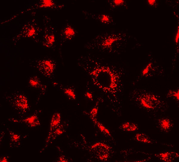 Cell Navigator® Lysosome Staining Kit *Orange Fluorescence* - AAT Bioquest