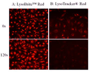 Cell Navigator® Lysosome Staining Kit *Red Fluorescence* - AAT Bioquest