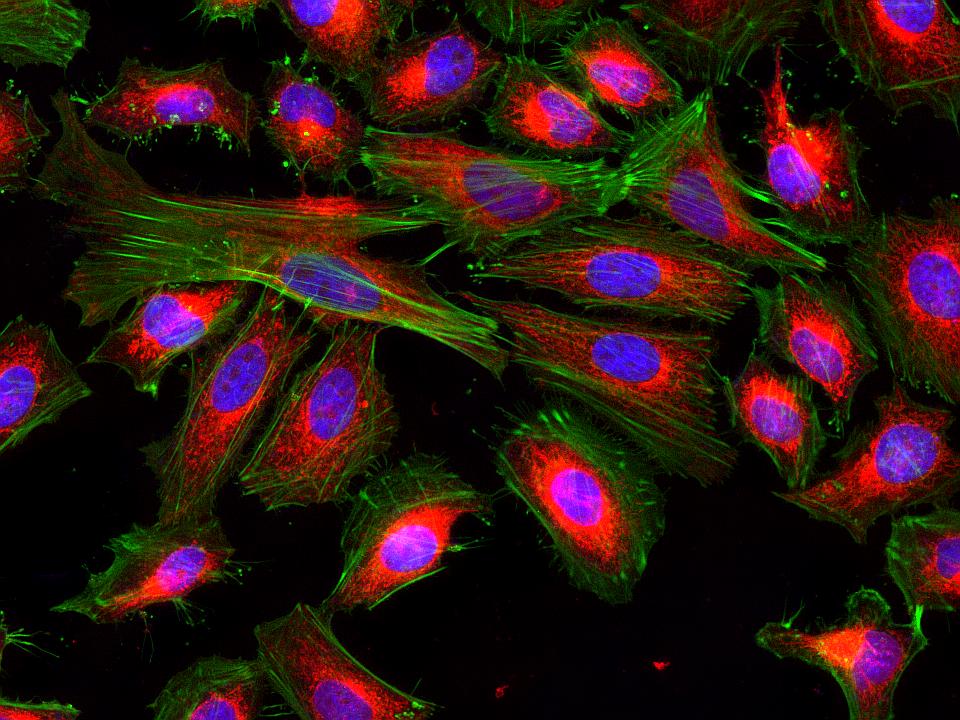 Cell Navigator® Mitochondrion Staining Kit *Red Fluorescence* - AAT Bioquest