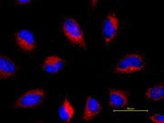 Cell Navigator® TMR Ceramide Golgi Staining Kit  *Red Fluorescence* - AAT Bioquest