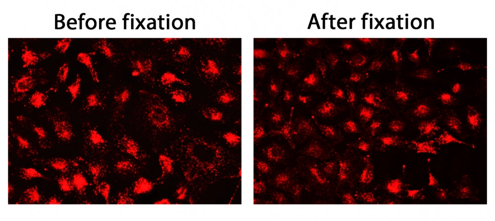 CytoFix™ Red Lysosomal Stain - AAT Bioquest