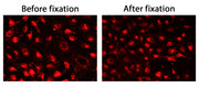 CytoFix™ Red Lysosomal Stain - AAT Bioquest