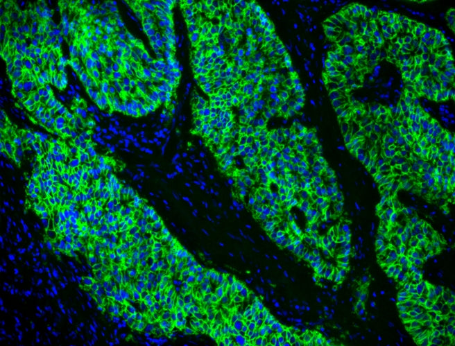 FluoroQuest™ Anti-fading Mounting Medium with DAPI - AAT Bioquest