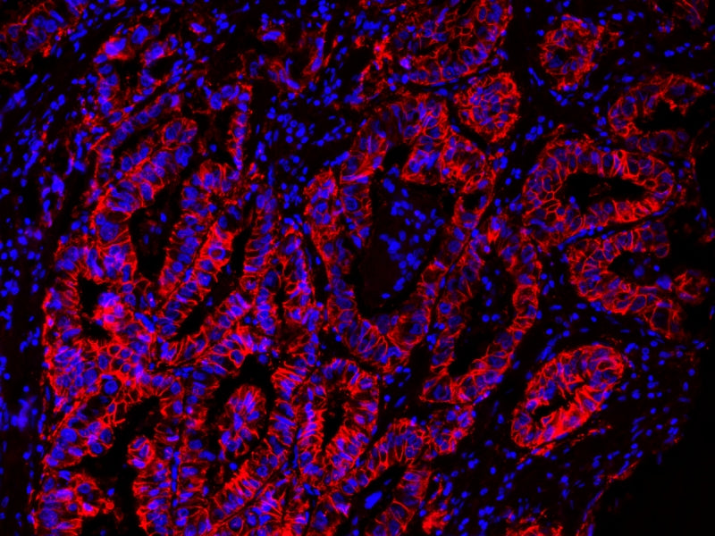 HRP-labeled goat anti-rabbit IgG (H+L) - AAT Bioquest
