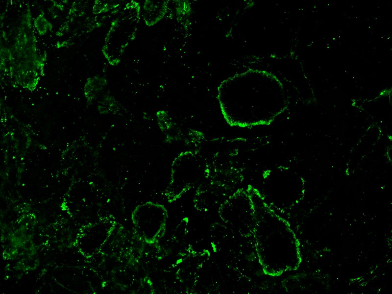 iFluor® 488-Concanavalin A Conjugate - AAT Bioquest