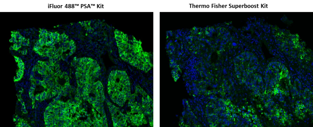 iFluor® 488 PSA™ Imaging Kit with Goat Anti-Rabbit IgG - AAT Bioquest