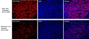 iFluor® 555 PSA™ Imaging Kit with Goat Anti-Mouse IgG - AAT Bioquest