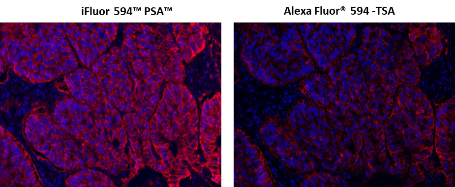 iFluor® 594 PSA™ Imaging Kit with Goat Anti-Mouse IgG - AAT Bioquest
