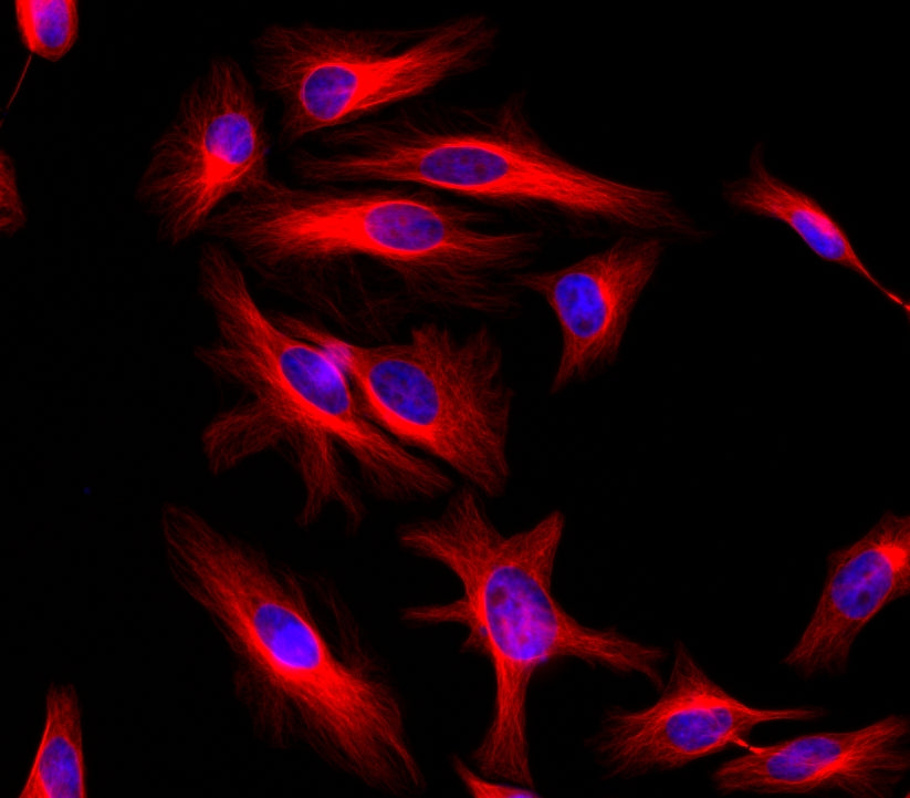 iFluor® 610 succinimidyl ester - AAT Bioquest