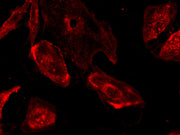 iFluor® 647-Concanavalin A Conjugate - AAT Bioquest