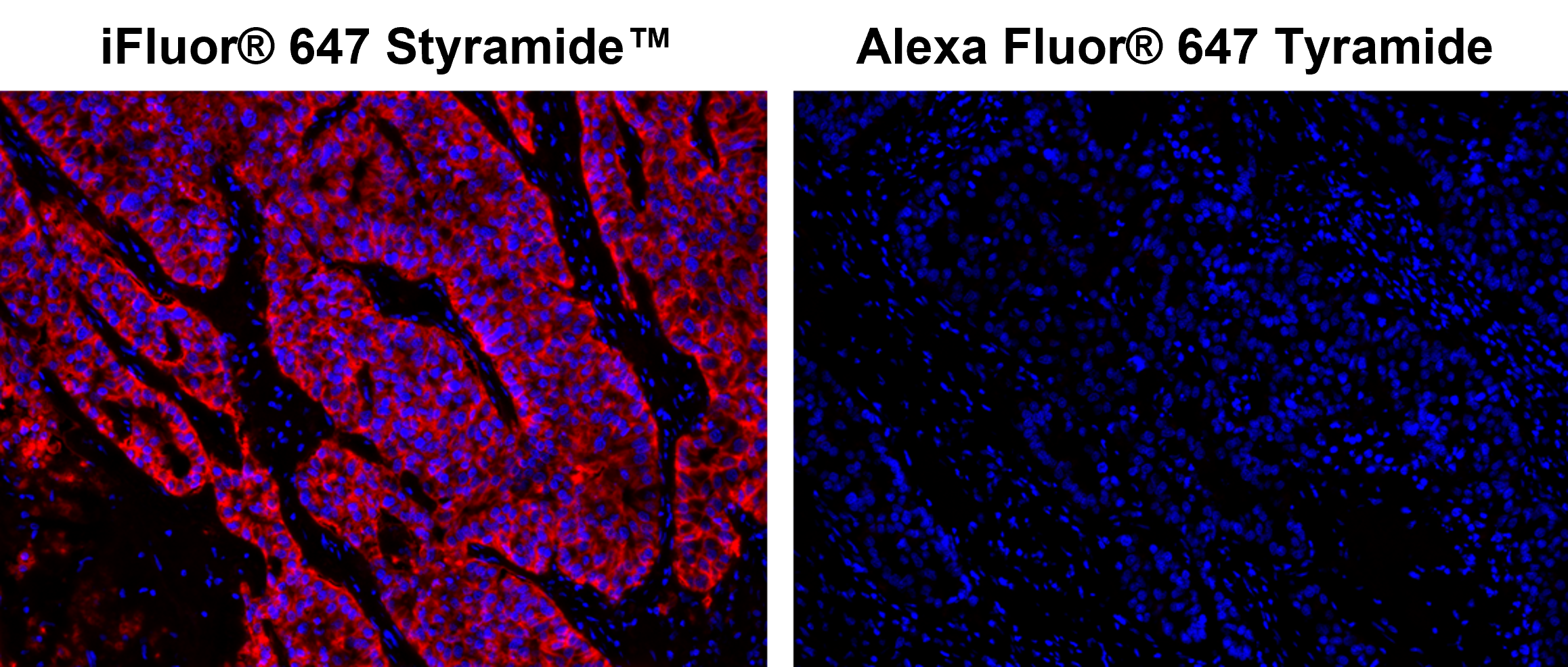 iFluor® 647 PSA™ Imaging Kit with Goat Anti-Mouse IgG - AAT Bioquest