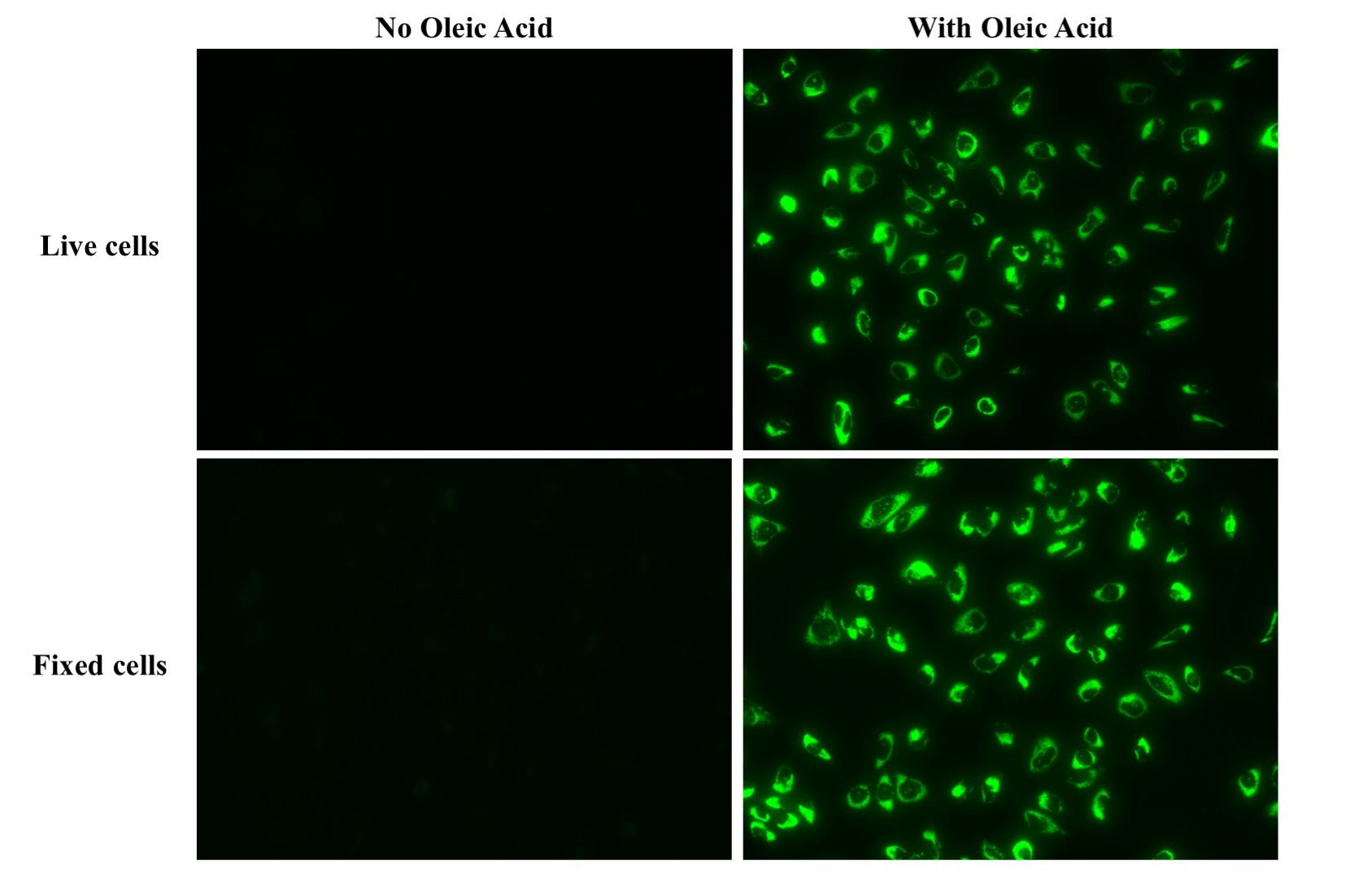 LipidLite™ Green Neutral Lipid Stain for Intracellular Imaging - AAT Bioquest