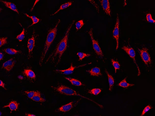 MitoLite™ Red CMXRos - AAT Bioquest