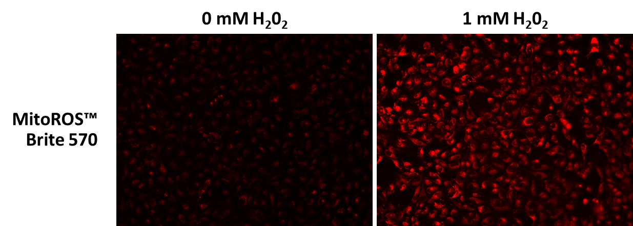 MitoROS Brite™ 570 *Optimized for Detecting Reactive Oxygen Species (ROS) in Mitochondria* - AAT Bioquest