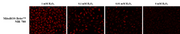 MitoROS Brite™ NIR 780 *Optimized for Detecting Reactive Oxygen Species (ROS) in Mitochondria* - AAT Bioquest