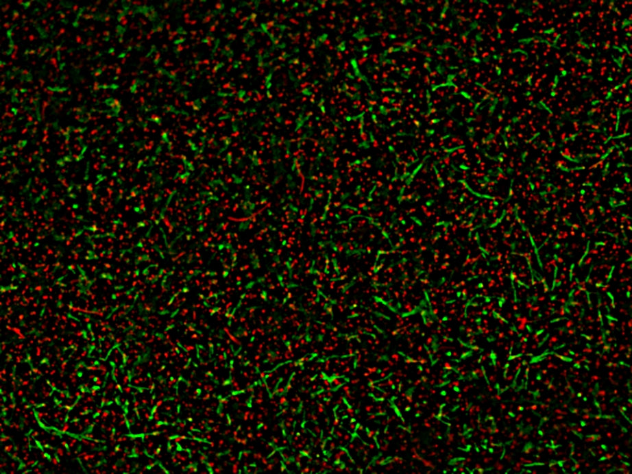 MycoLight™ Fluorescence Live/Dead Bacterial Imaging Kit - AAT Bioquest