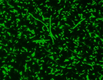 MycoLight™ Green JJ98 *5 mM in DMSO* - AAT Bioquest
