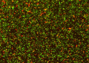 MycoLight™ Rapid Fluorescence Bacterial Gram Stain Kit - AAT Bioquest