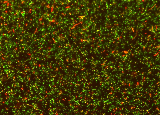 MycoLight™ Rapid Fluorescence Bacterial Gram Stain Kit - AAT Bioquest