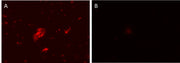 MycoLight™ Rapid Fluorescence Gram-Positive Bacteria Staining Kit - AAT Bioquest