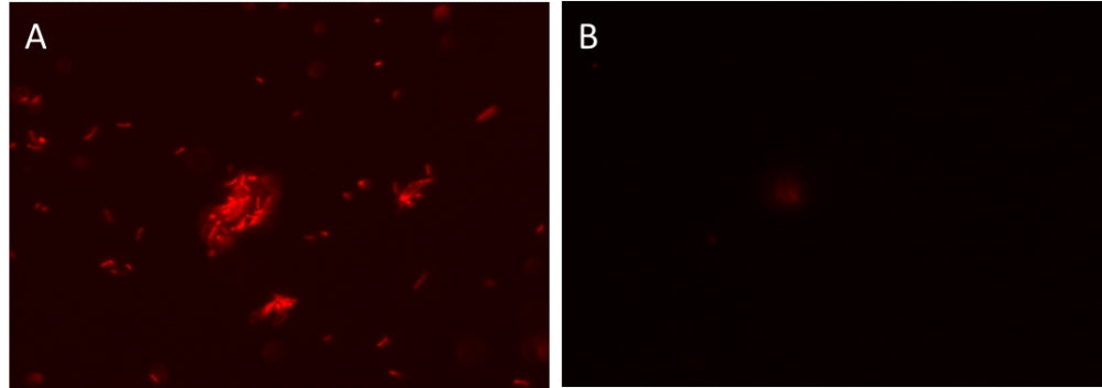 MycoLight™ Rapid Fluorescence Gram-Positive Bacteria Staining Kit - AAT Bioquest