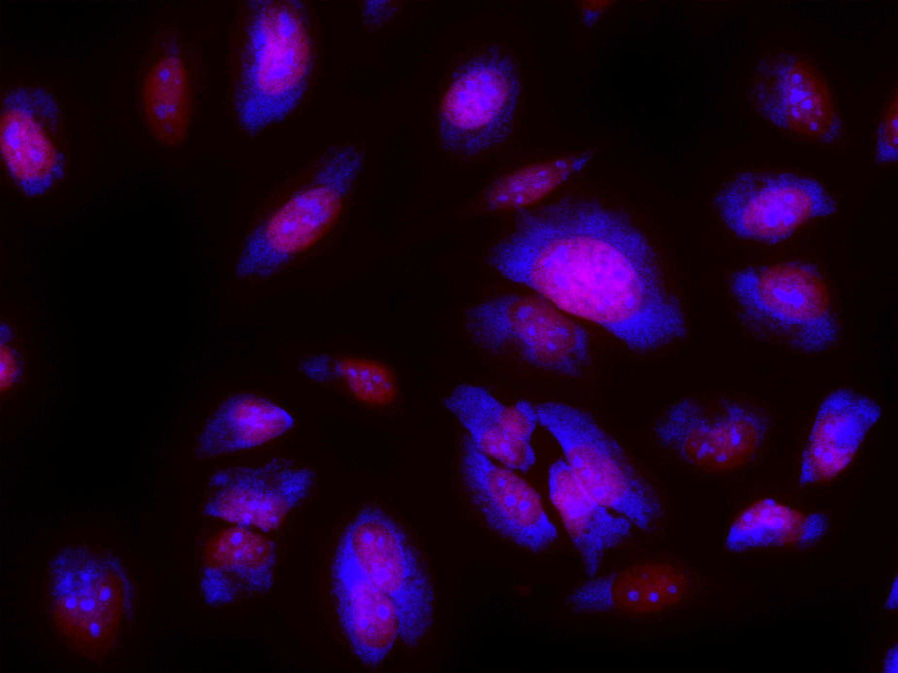 Nucleolus Blue™ DCS1 *Dead Cell Staining* - AAT Bioquest