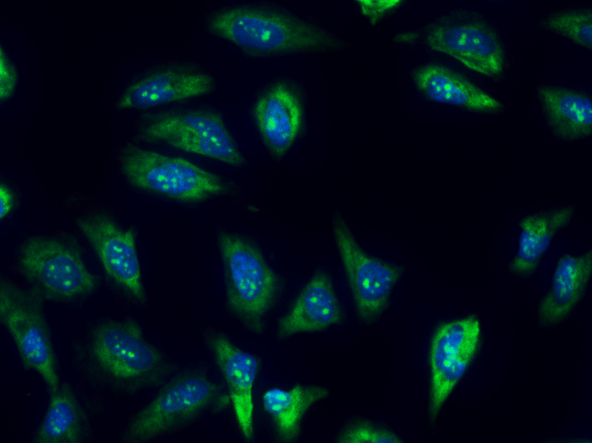 Nucleolus Green™ LCS1 *Cell-Permeable* - AAT Bioquest