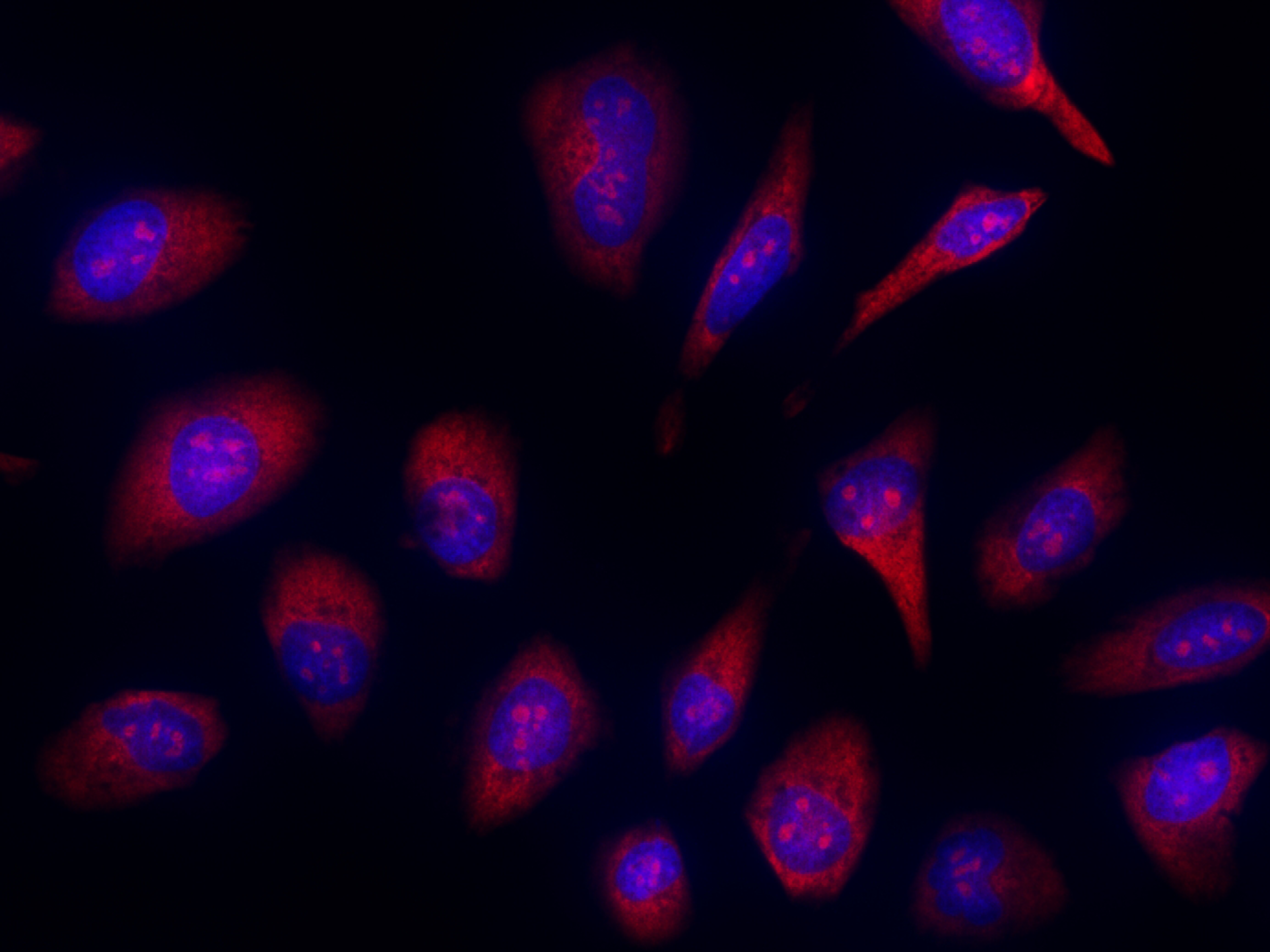 Nucleolus Red™ DCS1 *Dead Cell Staining* - AAT Bioquest