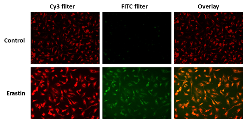 OxiVision™ Ratiometric Mitochondrial Lipid Peroxidation Sensor - AAT Bioquest