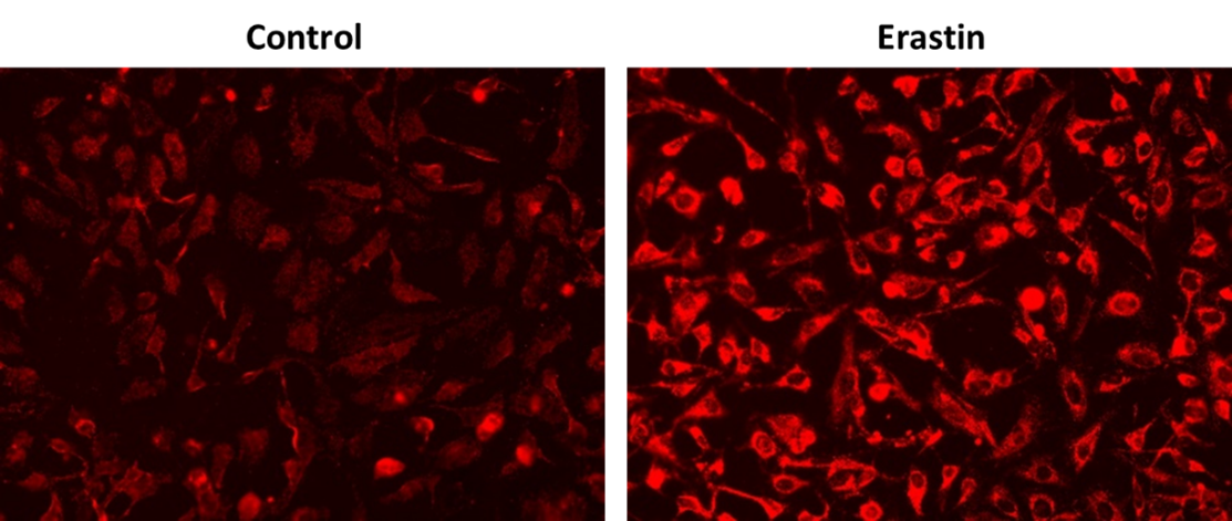 OxiVision™ Red Mitochondrial Lipid Peroxidation Sensor - AAT Bioquest