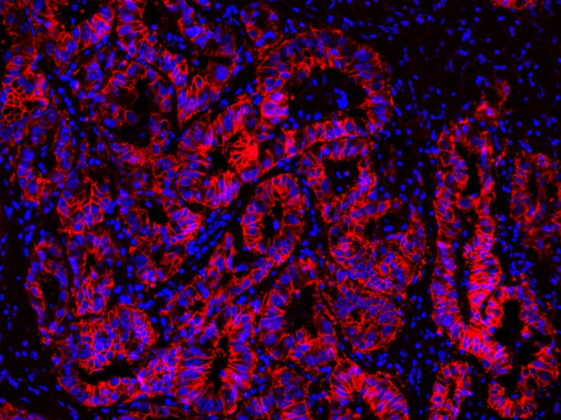 ReadiLink™ Rapid iFluor® 555 Antibody Labeling Kit *Microscale Optimized for Labeling 50 μg Antibody Per Reaction* - AAT Bioquest