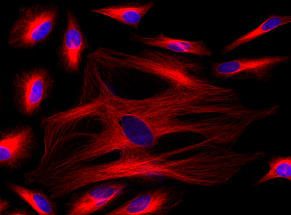ReadiLink™ xtra Rapid Cy5 Antibody Labeling Kit *BSA-Compatible* - AAT Bioquest