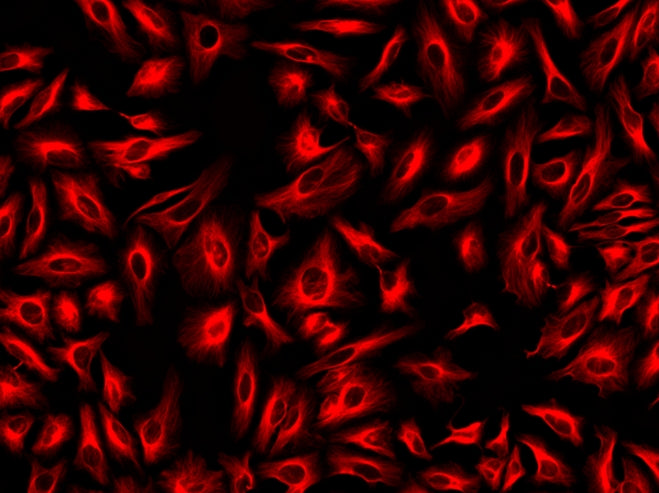 ReadiLink™ xtra Rapid iFluor® 555 Antibody Labeling Kit *BSA-Compatible* - AAT Bioquest