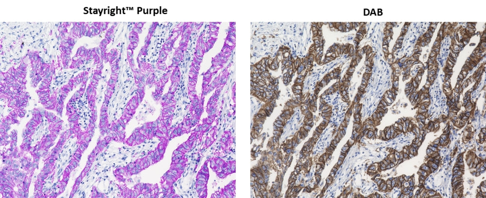 ReadiUse™ Stayright™ Purple *HRP Chromogen Premixed with Hydrogen Peroxide* - AAT Bioquest