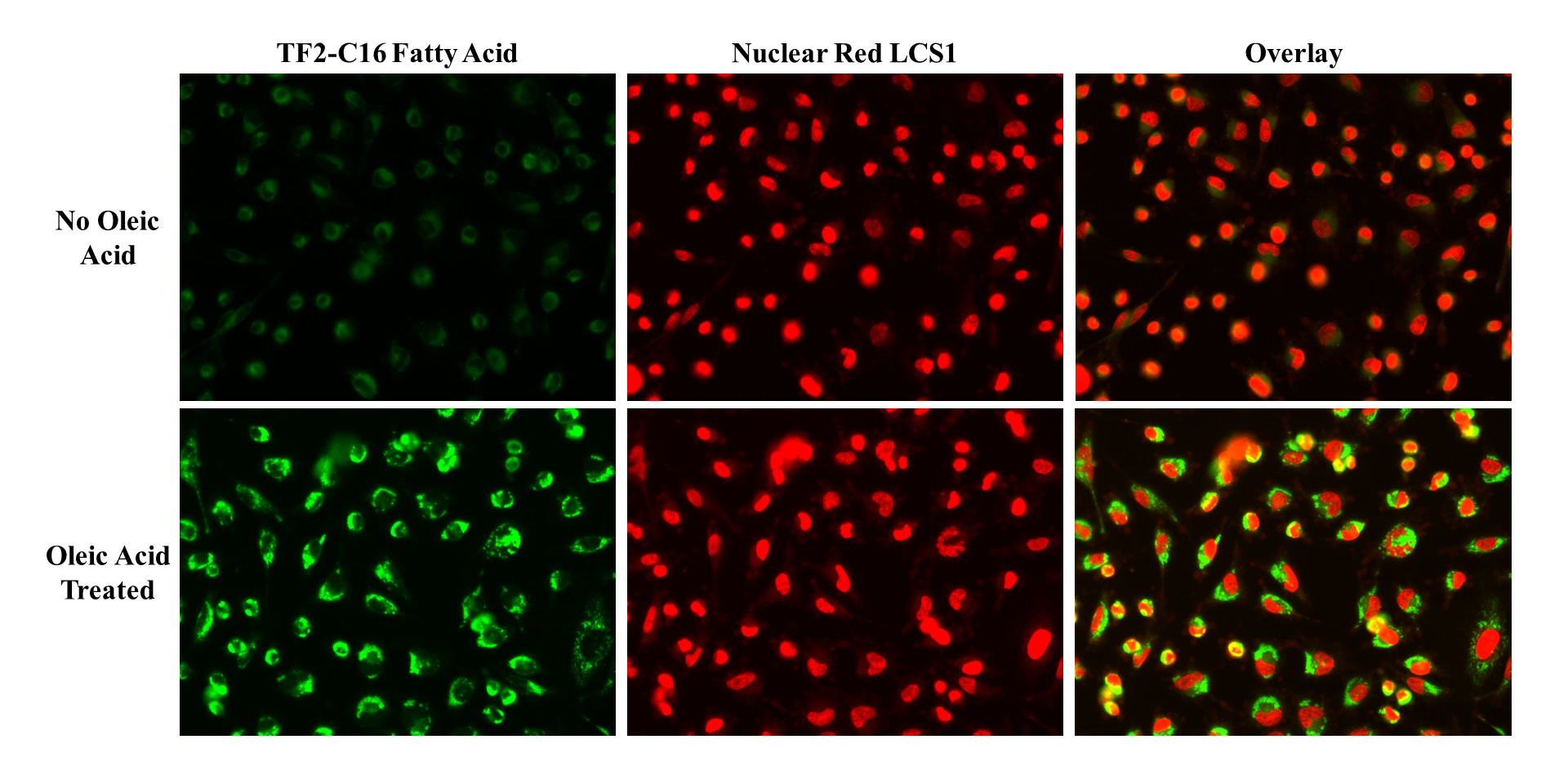 Screen Quest™ Fluorimetric Long Chain Fatty Acid Uptake Assay Kit - AAT Bioquest