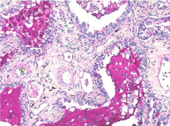 Stayright™ Periodic Acid Schiff (PAS) Stain Kit (Mucin Stain) - AAT Bioquest