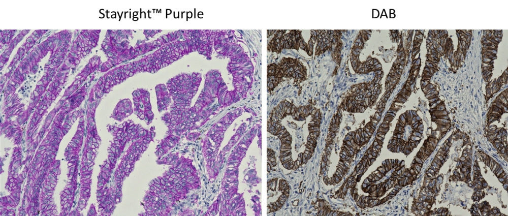 Stayright™ Purple HRP Staining Kit - AAT Bioquest