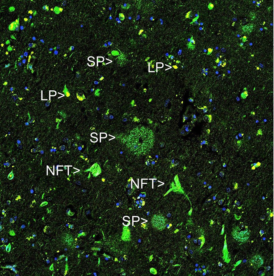 Thioflavin S *CAS 1326-12-1* - AAT Bioquest