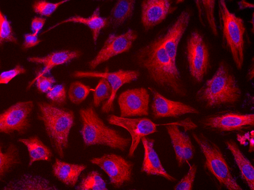 Tubulite™ Red *Cell-Permeable* - AAT Bioquest