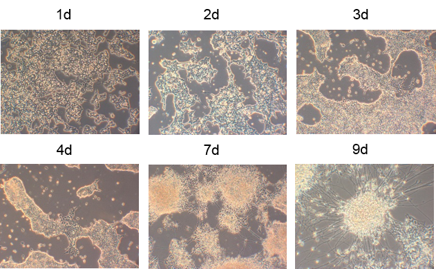 NDiff 227: neural differentiation medium - Stem cell research - Takara Bio