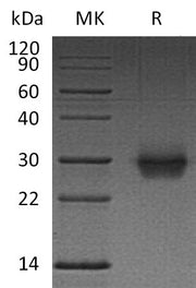 Recombinant Human CD40 (C-6His)