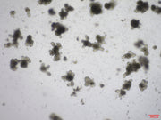 Recombinant Human RSPO1 (C-6His)