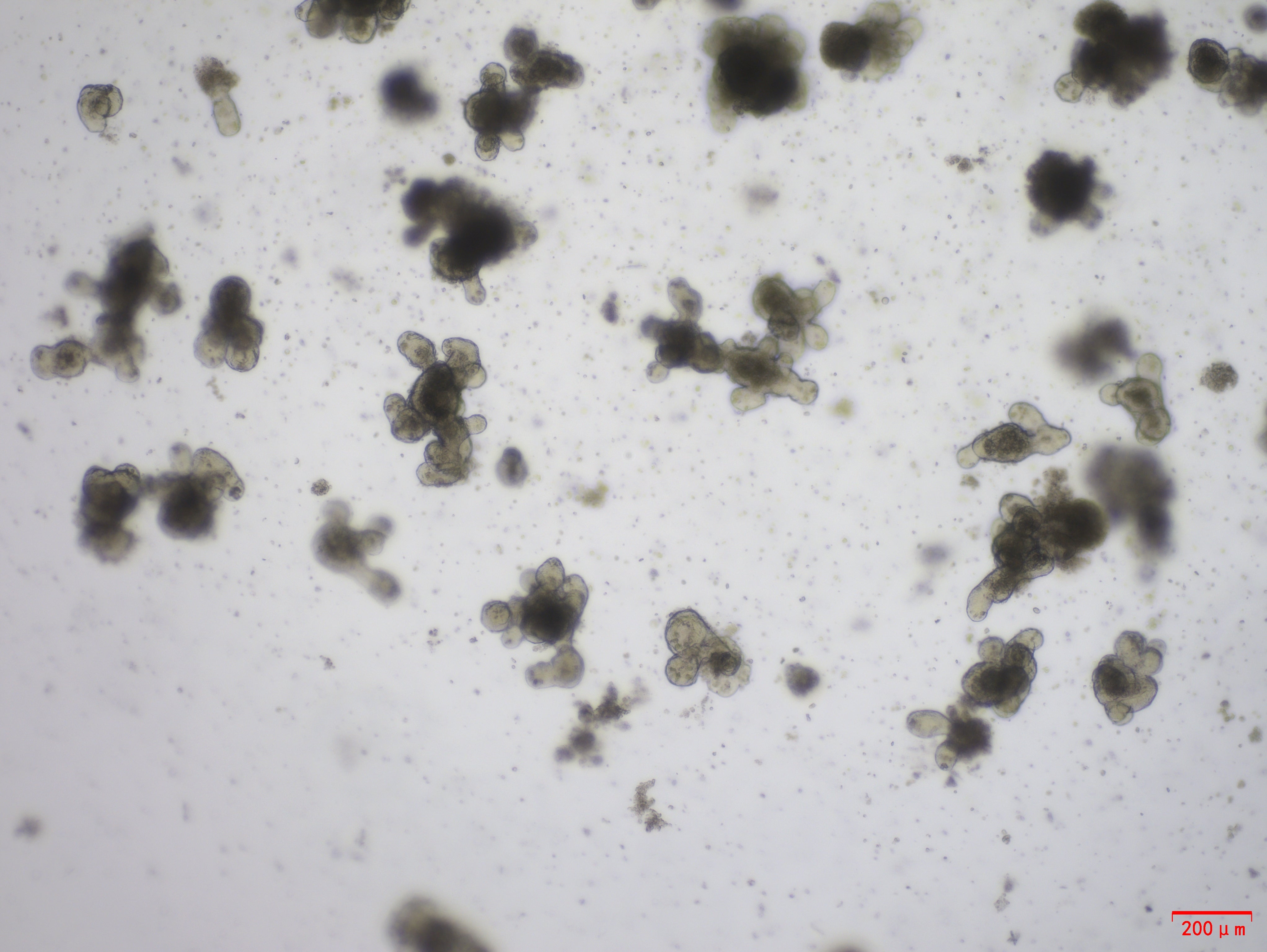 Recombinant Human RSPO1 (C-6His)