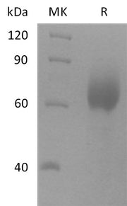 Recombinant Human SCARB2 (C-6His)