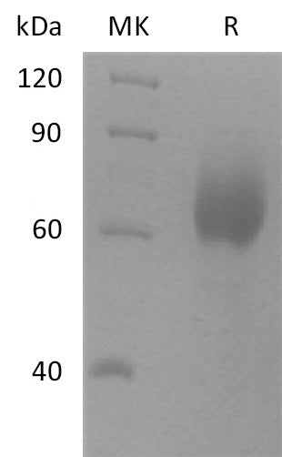 Recombinant Human SCARB2 (C-6His)