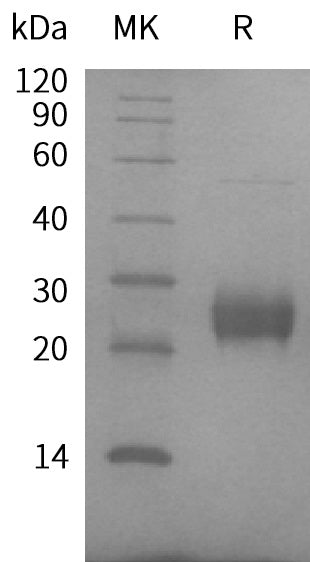 Recombinant Human FAM3D (C-6His)